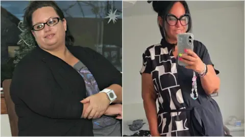 Many Lost Weight With Injections – Then Came the Loose Skin
